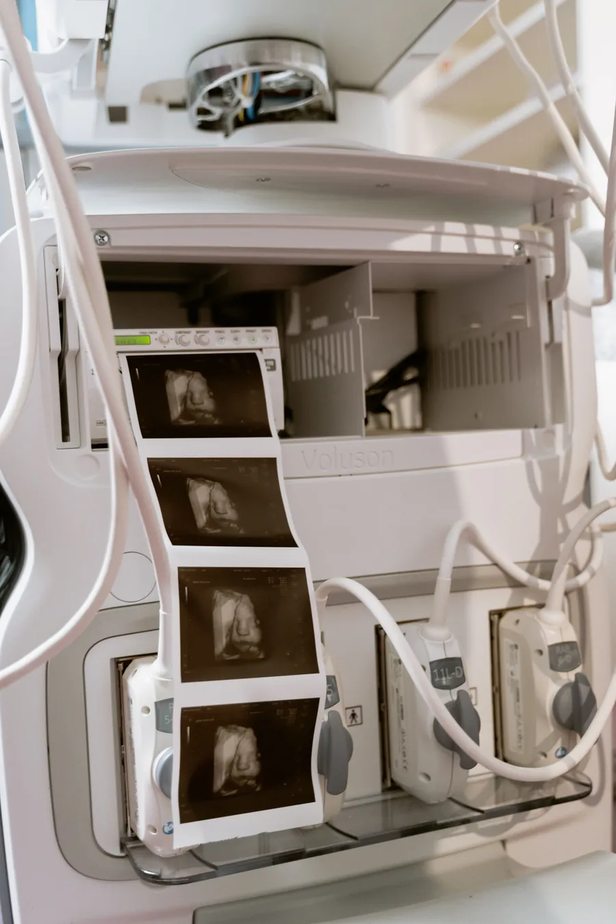 Bladder symptom planning